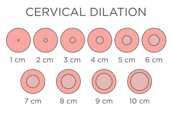 The Reality of Labor: 10cm Dilated Cervix Real Pictures