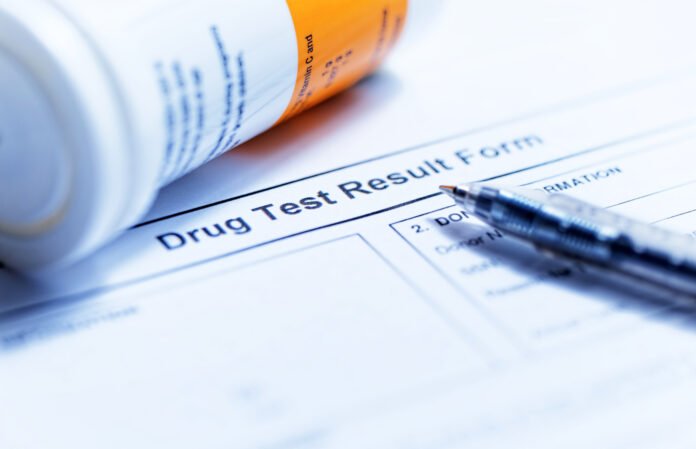 Should You Order an Employee Drug Test?