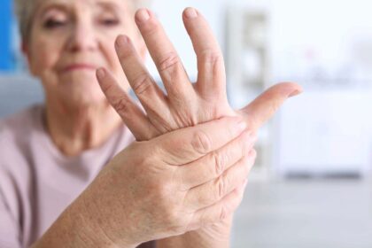 When Should You Be Concerned About Arthritis?
